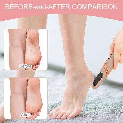 Electric Foot  Callus Remover